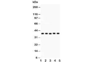 Western blot testing of KLF6 antibody and Lane 1:  human placenta (KLF6 抗体  (AA 38-205))