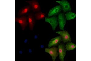 ABIN6257390 and ABIN6273800 staining  cells by IF/ICC.