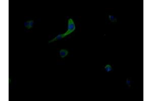 Immunofluorescent analysis of MCF-7 cells using ABIN7159013 at dilution of 1:100 and Alexa Fluor 488-congugated AffiniPure Goat Anti-Rabbit IgG(H+L) (MRGPRX2 抗体  (AA 286-330))