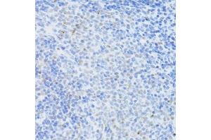 Immunohistochemistry (IHC) image for anti-DNA (Cytosine-5)-Methyltransferase 1 (DNMT1) (AA 1-270) antibody (ABIN7266810)