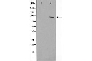 Western blot analysis on HepG2 cell lysate using ZNF148 Antibody，The lane on the left is treated with the antigen-specific peptide. (ZNF148 抗体  (N-Term))