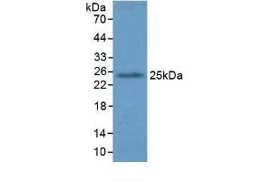 Detection of GSTA4 in Mouse Lung Tissue using Polyclonal Antibody to Glutathione S Transferase A4 (GSTA4) (GSTA4 抗体  (AA 1-222))
