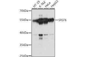 Western blot analysis of extracts of various cell lines, using SRSF6 antibody (ABIN7270217) at 1:1000 dilution. (SFRS6 抗体  (AA 1-100))
