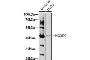 Western blot analysis of extracts of various cell lines, using HOXD9 antibody (ABIN7267776) at 1:1000 dilution. (HOXD9 抗体  (AA 100-200))