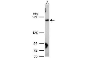 WB Image Sample (30 ug of whole cell lysate) A: Hela 5% SDS PAGE antibody diluted at 1:1000 (COL3A1 抗体  (C-Term))