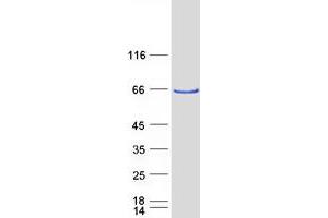 Western Blotting (WB) image for Arginyltransferase 1 (ATE1) (Transcript Variant 2) protein (Myc-DYKDDDDK Tag) (ABIN2715018)