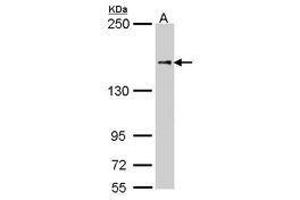 Image no. 2 for anti-Nuclear Factor of Activated T-Cells 5, Tonicity-Responsive (NFAT5) (AA 41-298) antibody (ABIN467533) (NFAT5 抗体  (AA 41-298))