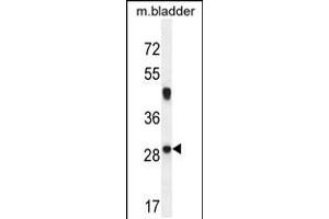Western blot analysis in mouse bladder tissue lysates (35ug/lane). (NCALD 抗体  (C-Term))