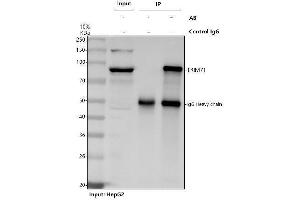 anti-Tripartite Motif Containing 71, E3 Ubiquitin Protein Ligase (TRIM71) (AA 85-868) antibody