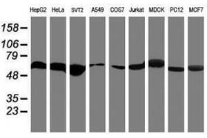 Image no. 6 for anti-Ring Finger Protein 113B (RNF113B) antibody (ABIN1500715) (RNF113B 抗体)
