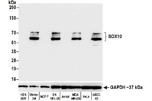 Western Blotting (WB) image for anti-SRY (Sex Determining Region Y)-Box 10 (SOX10) (AA 416-466) antibody (ABIN7454037) (Recombinant SOX10 抗体  (AA 416-466))