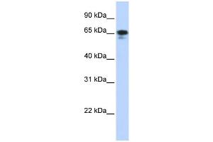 WB Suggested Anti-ZNF276 Antibody Titration:  0.