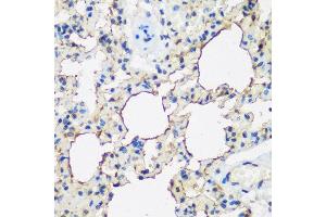 Immunohistochemistry of paraffin-embedded rat lung using ALOX15 antibody at dilution of 1:200 (40x lens). (ALOX15 抗体)