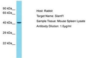 Image no. 1 for anti-Signaling Lymphocytic Activation Molecule Family Member 1 (SLAMF1) (AA 141-190) antibody (ABIN6750480) (SLAMF1 抗体  (AA 141-190))