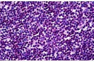 Human Tonsil: Formalin-Fixed, Paraffin-Embedded (FFPE) (MKNK1 抗体  (AA 1-466))