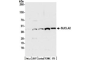 Western Blotting (WB) image for anti-Succinate-CoA Ligase, ADP-Forming, beta Subunit (SUCLA2) (AA 50-100) antibody (ABIN7453213)