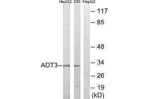 Western Blotting (WB) image for anti-Solute Carrier Family 25 (Mitochondrial Carrier, Adenine Nucleotide Translocator), Member 6 (SLC25A6) (Internal Region) antibody (ABIN1850696) (SLC25A6 抗体  (Internal Region))