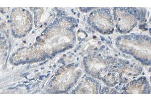 ABIN6269324 at 1/100 staining Human prostate tissue by IHC-P. (LIPE 抗体  (Internal Region))