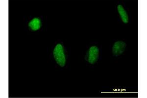 Immunofluorescence of purified MaxPab antibody to MSL3L1 on HeLa cell. (MSL3 抗体  (AA 1-521))