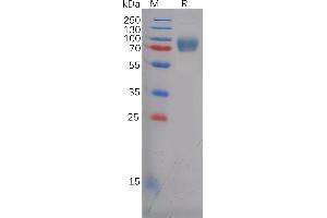 Human E Protein, His Tag on SDS-PAGE under reducing condition.