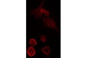 ABIN6275724 staining  HeLa cells by IF/ICC. (MED27 抗体  (Internal Region))