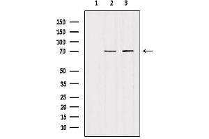 Western blot analysis of extracts from various samples, using HGFAC Antibody. (HGFA 抗体  (C-Term))