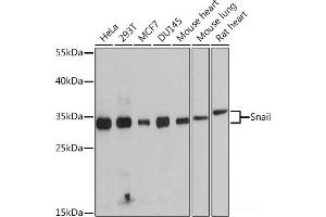 Western blot analysis of extracts of various cell lines using Snail Polyclonal Antibody at dilution of 1:1000. (SNAIL 抗体)