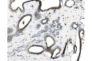 IHC analysis of CGKI/PRKG1 using anti-CGKI/PRKG1 antibody (ABIN7600502).