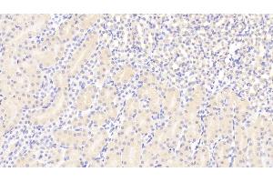 Immunohistochemistry (IHC) image for anti-Angiotensin I Converting Enzyme 2 (ACE2) (AA 93-464) antibody (ABIN7442351)