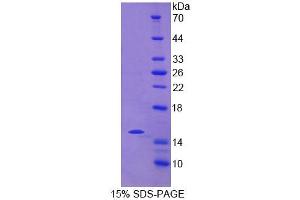 SDS-PAGE analysis of Human NCR2 Protein.