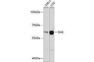 Western blot analysis of extracts of various cell lines using SIAE Polyclonal Antibody at dilution of 1:3000. (SIAE 抗体)
