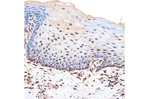 Immunohistochemistry of paraffin-embedded human esophageal using B Rabbit mAb (ABIN7265826) at dilution of 1:100 (40x lens). (BANF1 抗体)