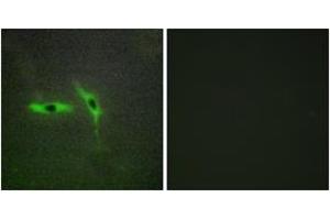 Immunofluorescence analysis of HepG2 cells, using TNFRSF6B Antibody. (TNFRSF6B 抗体  (AA 251-300))