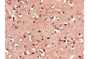 Immunohistochemistry of paraffin-embedded human brain tissue using ABIN7153193 at dilution of 1:100 (FZD8 抗体  (AA 55-233))