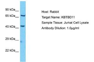 Host: Rabbit Target Name: KBTBD11 Sample Type: Jurkat Whole Cell lysates Antibody Dilution: 1. (KBTBD11 抗体  (Middle Region))