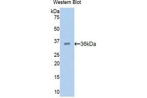 Western blot analysis of the recombinant protein. (PCSK9 抗体  (AA 156-461))