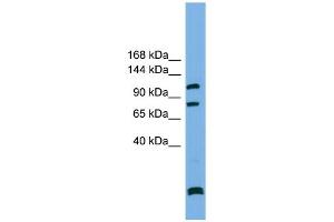 WB Suggested Anti-PPP6R1  Antibody Titration: 0. (SAPS1 抗体  (N-Term))