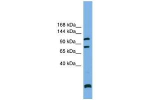 WB Suggested Anti-PPP6R1  Antibody Titration: 0.