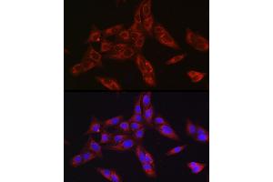 Immunofluorescence analysis of U-2 OS cells using Furin Rabbit pAb (ABIN6127933, ABIN6140815, ABIN6140817 and ABIN6223322) at dilution of 1:150 (40x lens). (FURIN 抗体  (AA 120-370))