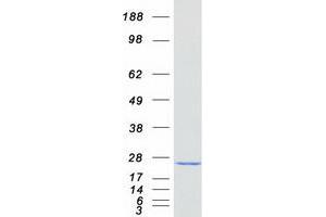 Western Blotting (WB) image for CASP2 and RIPK1 Domain Containing Adaptor with Death Domain (CRADD) protein (Myc-DYKDDDDK Tag) (ABIN2730429)