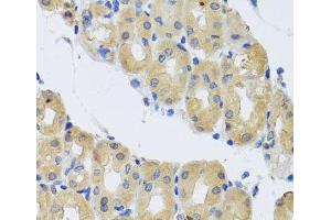 Immunohistochemistry of paraffin-embedded Human stomach using DYNC1I1 Polyclonal Antibody at dilution of 1:100 (40x lens). (DYNC1I1 抗体)
