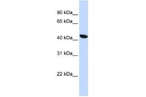 TMEM117 antibody used at 1 ug/ml to detect target protein. (TMEM117 抗体  (Middle Region))