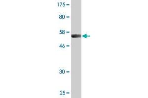 Western Blot detection against Immunogen (55. (VWF 抗体  (AA 1-273))