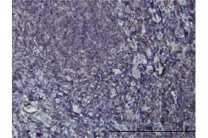 Immunoperoxidase of monoclonal antibody to EPHB3 on formalin-fixed paraffin-embedded human tonsil. (EPH Receptor B3 抗体  (AA 899-997))