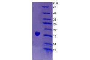 Image no. 1 for Endothelin 1 (EDN1) (AA 54-202) (Active) protein (His tag) (ABIN6239857)