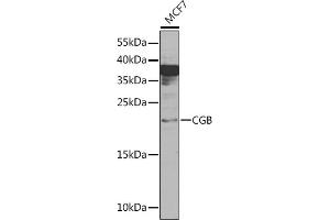 Western blot analysis of extracts of MCF7 cells, using CGB Rabbit pAb (ABIN6129262, ABIN6138471, ABIN6138472 and ABIN6216035) at 1:1000 dilution. (CGB 抗体  (AA 21-165))