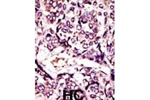 Immunohistochemistry (Paraffin-embedded Sections) (IHC (p)) image for anti-ADP Ribosylation Factor Like GTPase 1 (ARL1) (AA 1-30), (N-Term) antibody (ABIN388997)