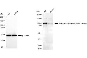 Western blotting analysis using Eukaryotic elongation factor 2 kinase antibody (ABIN7798497). (EEF2K 抗体)