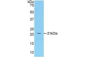 Detection of Recombinant BAFF, Human using Polyclonal Antibody to B-Cell Activating Factor (BAFF) (BAFF 抗体  (AA 113-283))