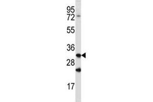 Cathepsin Q antibody western blot analysis in mouse spleen tissue lysate (Cathepsin Q 抗体  (AA 192-221))